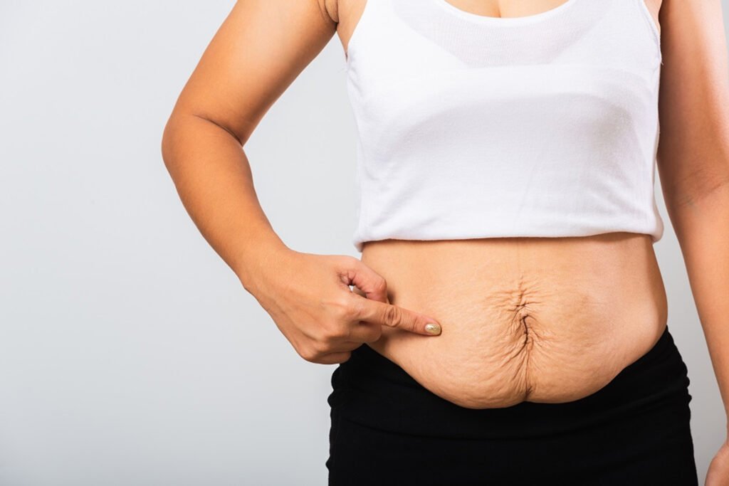 Mediyatra Gastric Sleeve Surgery