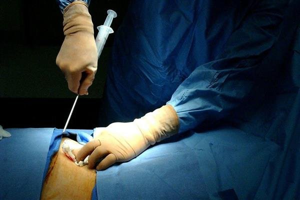 Mediyatra Bone Marrow Transplant