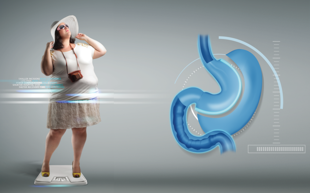 Transforming Lives: A Comprehensive Guide to Bariatric Surgery in India
